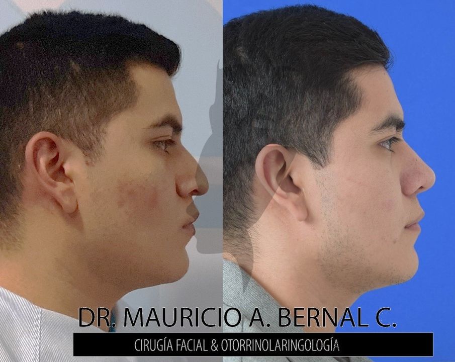 Mauricio Alejandro Bernal Carreon-26