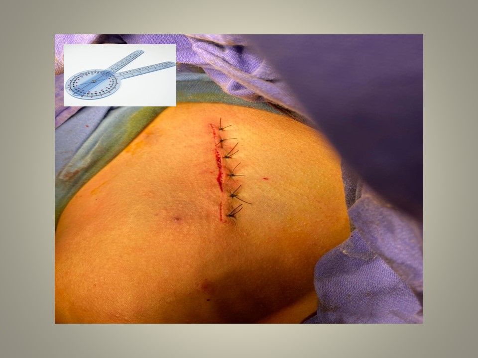 Jeftte Aaron Chacon Martinez-9