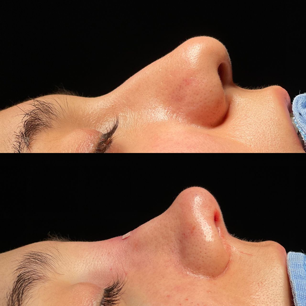 Angel Castro Urquizo-168