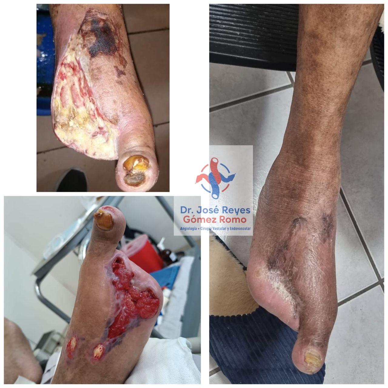 José Reyes Gómez Romo-0