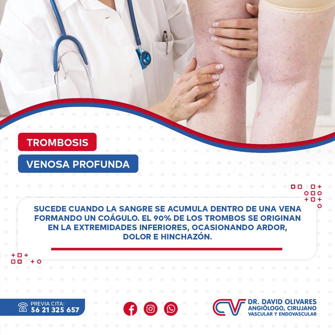 Jorge David Olivares Garcia-11