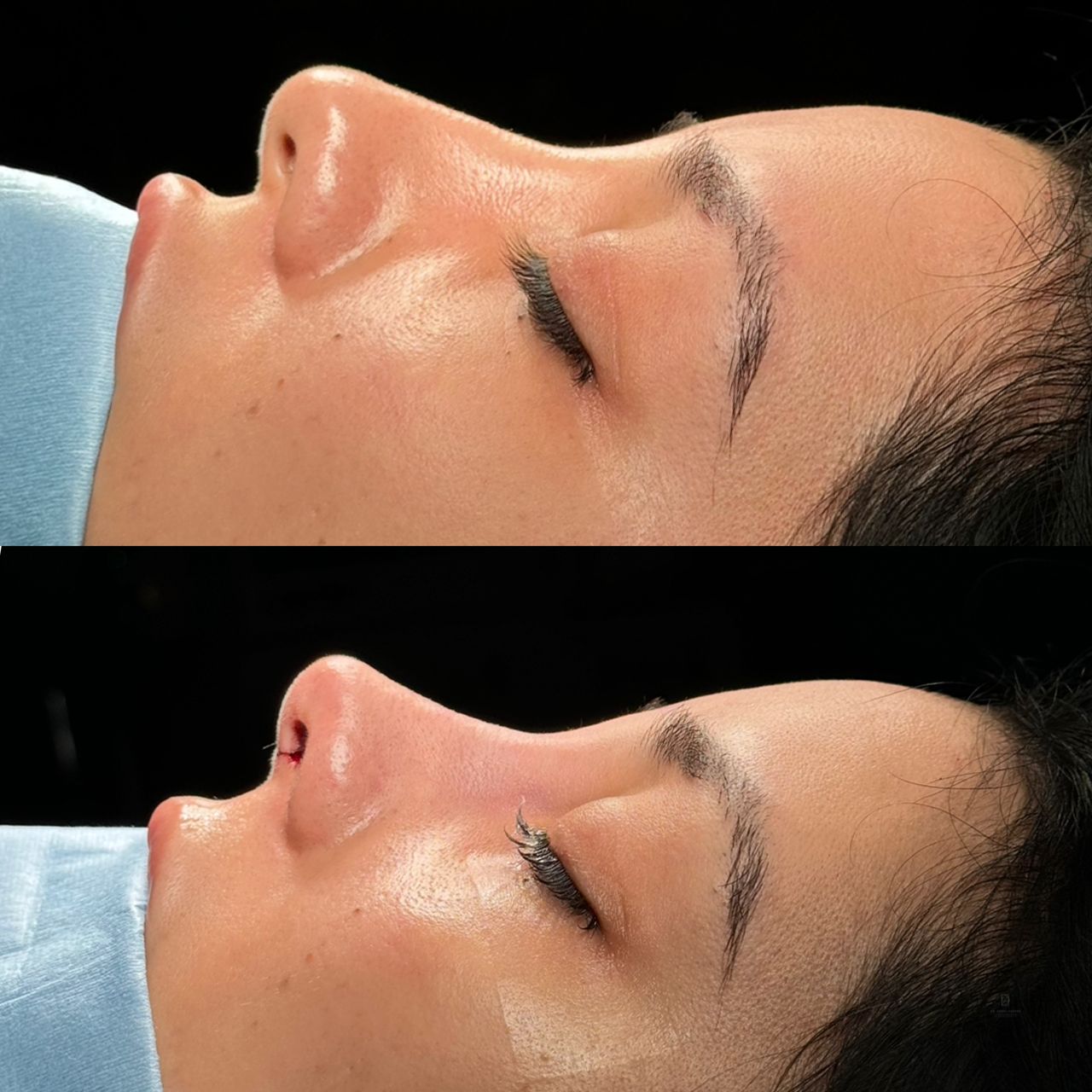 Angel Castro Urquizo-10