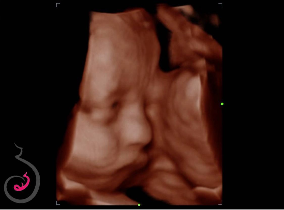 Carlos Humberto Montemayor Villalon-15