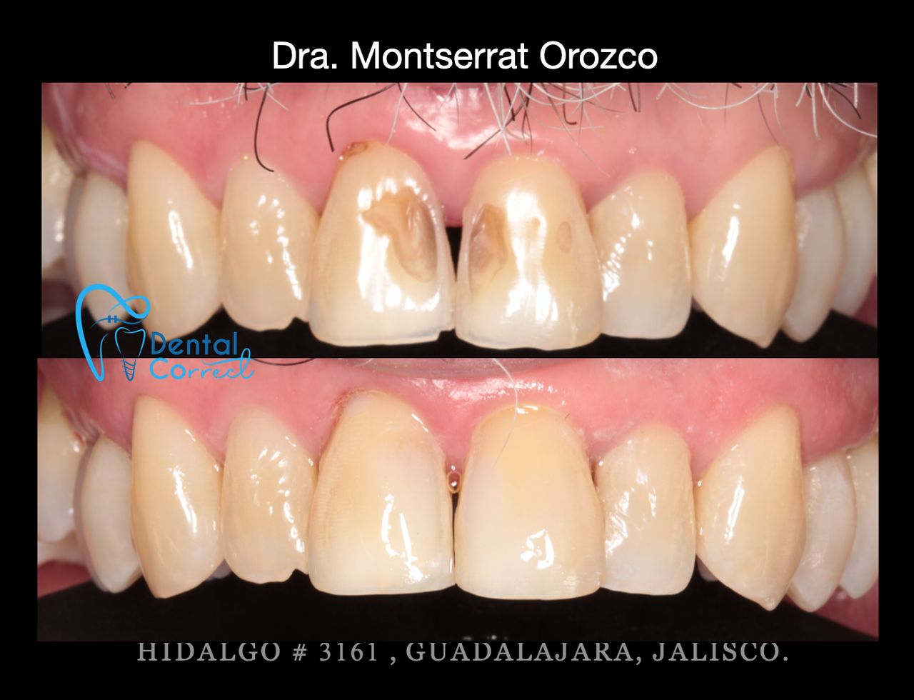 Aide Montserrat Orozco Gutierrez-47