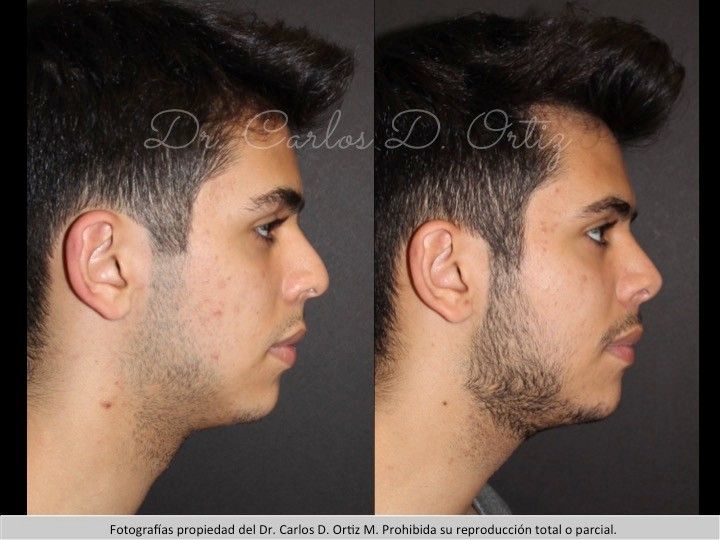 Carlos David Ortiz Moreno-12