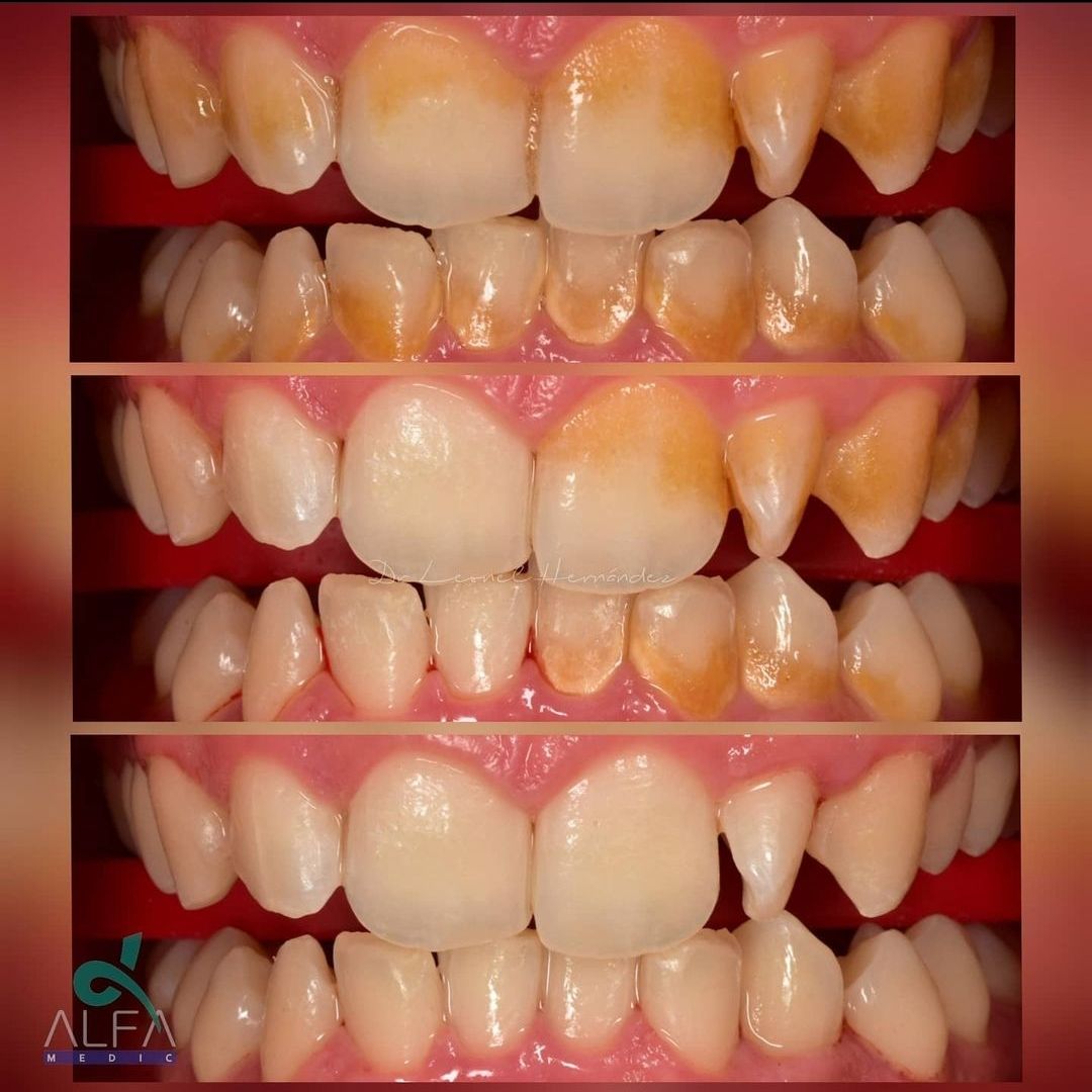 Leonel Hernández Gómez-18