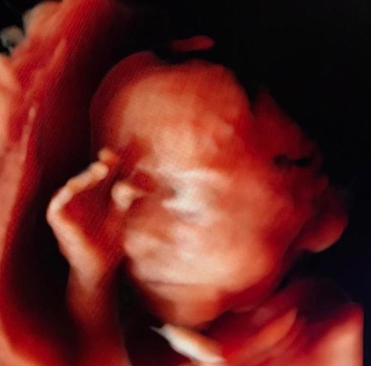 Germán Gabriel Palacios López-10