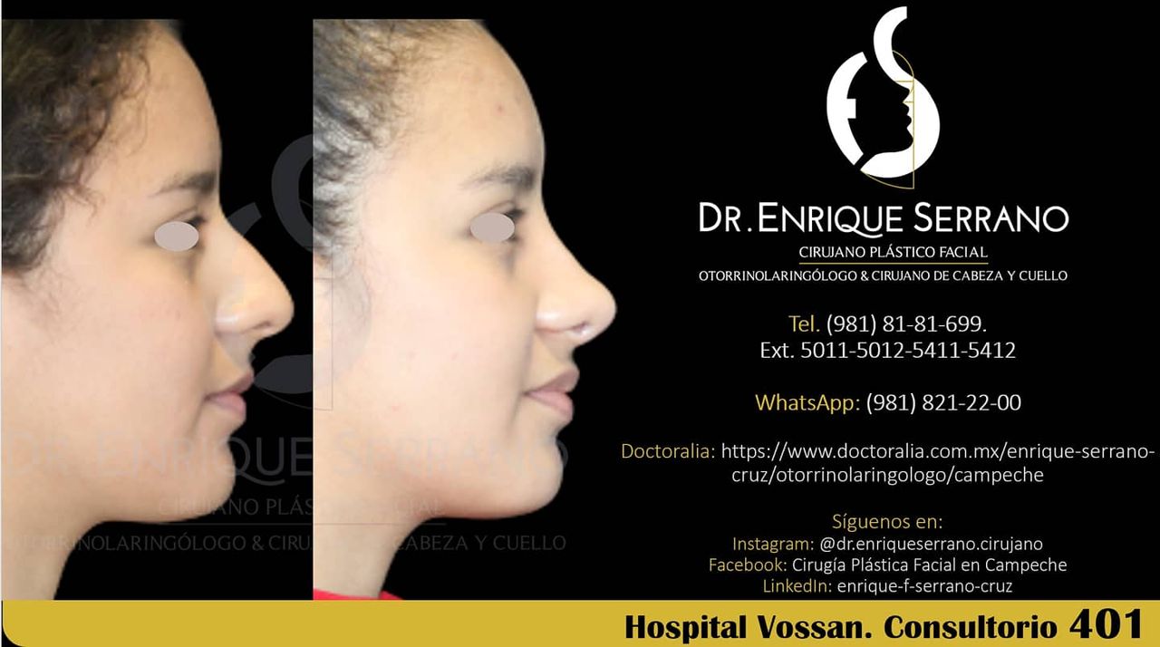 Enrique Serrano Cruz-113