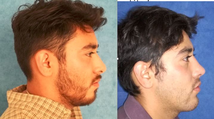 Marisol Ceja Zepeda-44