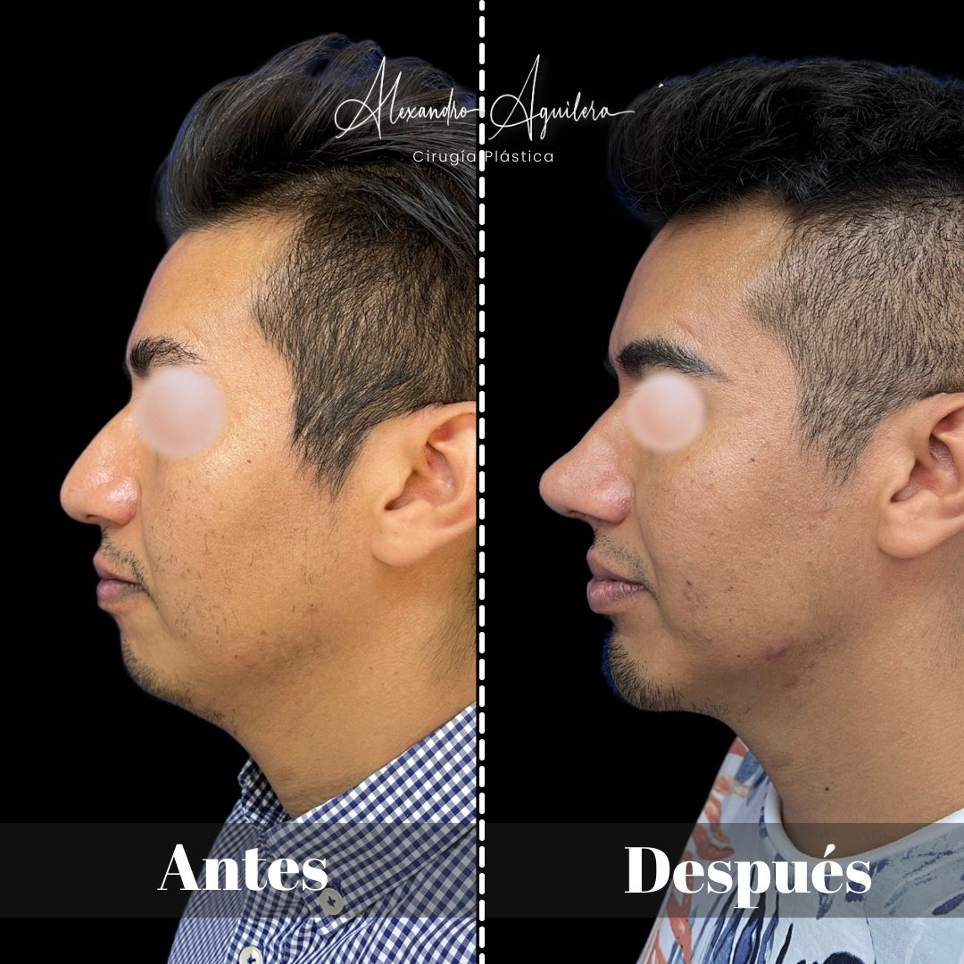 Alexandro Aguilera Salgado-43