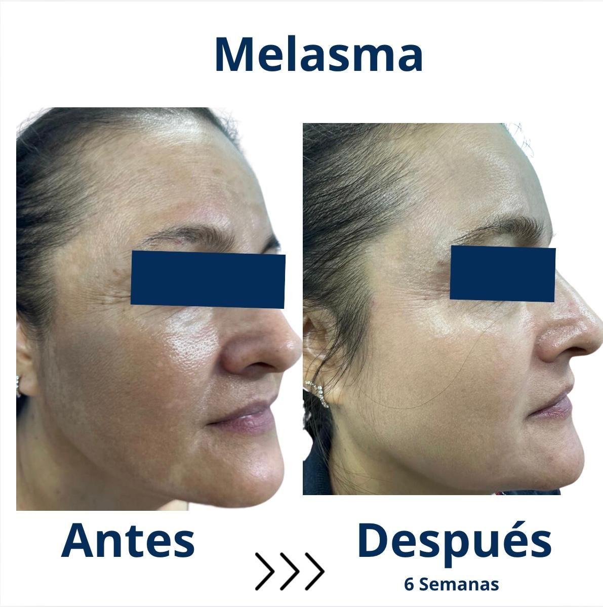 Itzel Anayn Flores Reyes-13