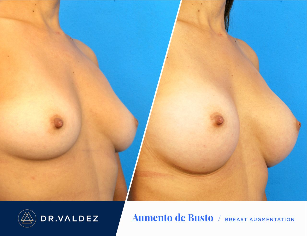 Pedro Arturo Valdez Gomez-21