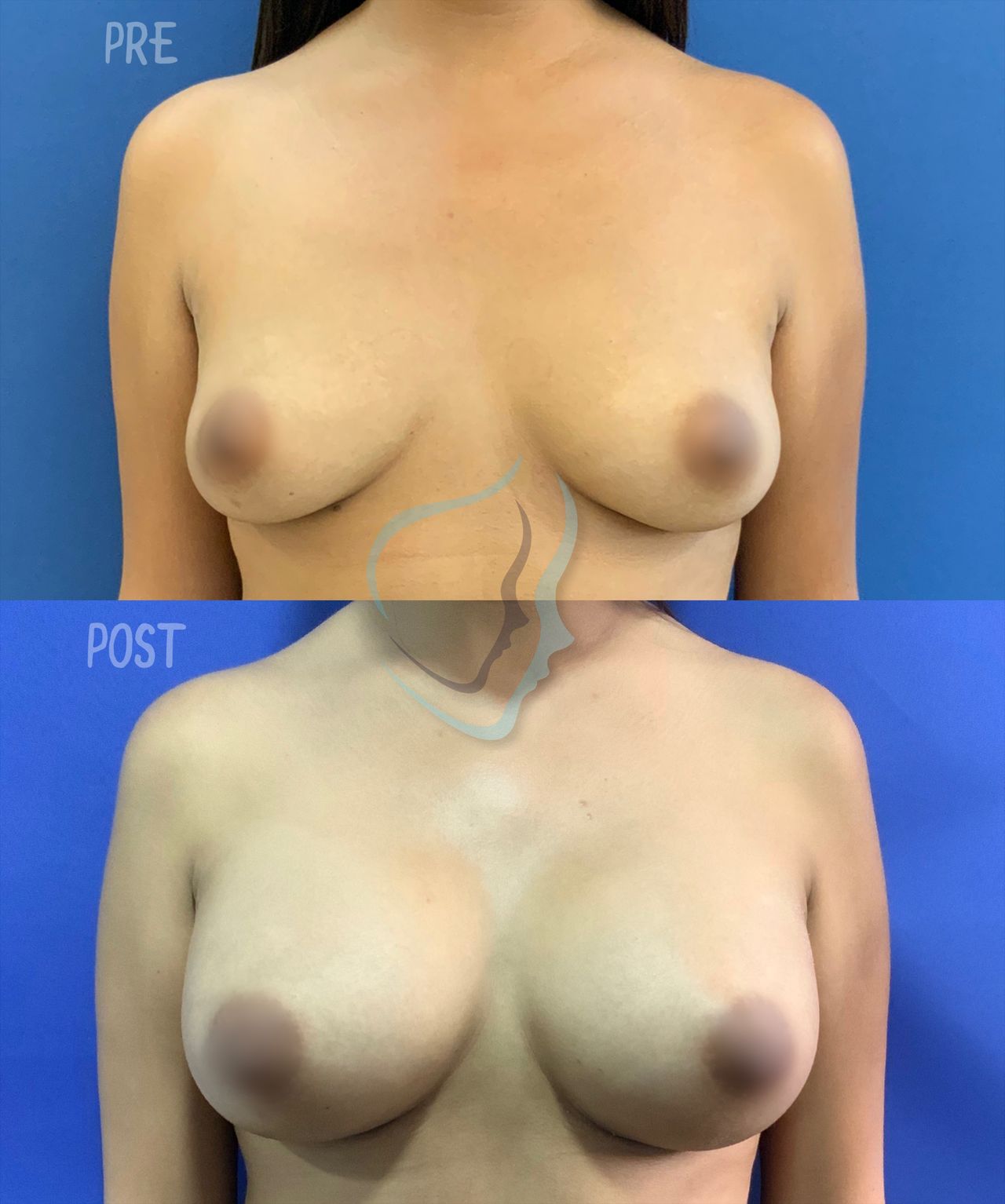 Giuseppe Tanzillo-58