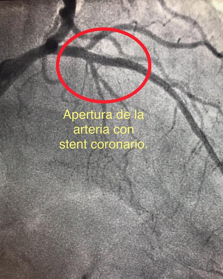Carlos Alberto Aguirre Molina-5