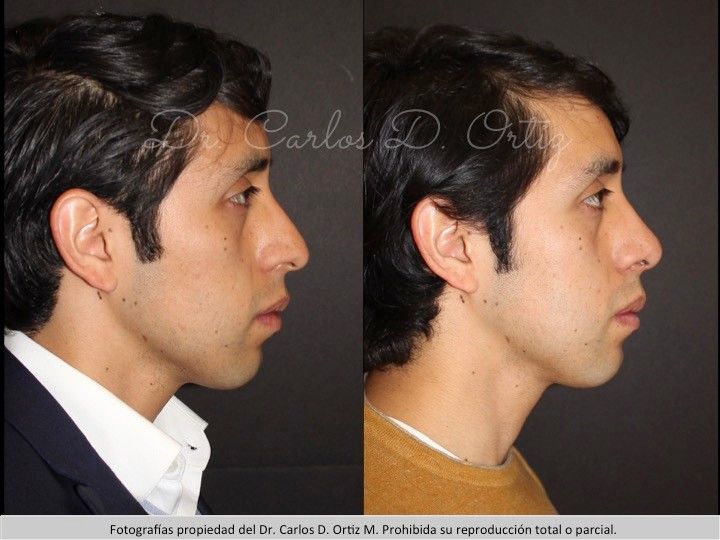 Carlos David Ortiz Moreno-28