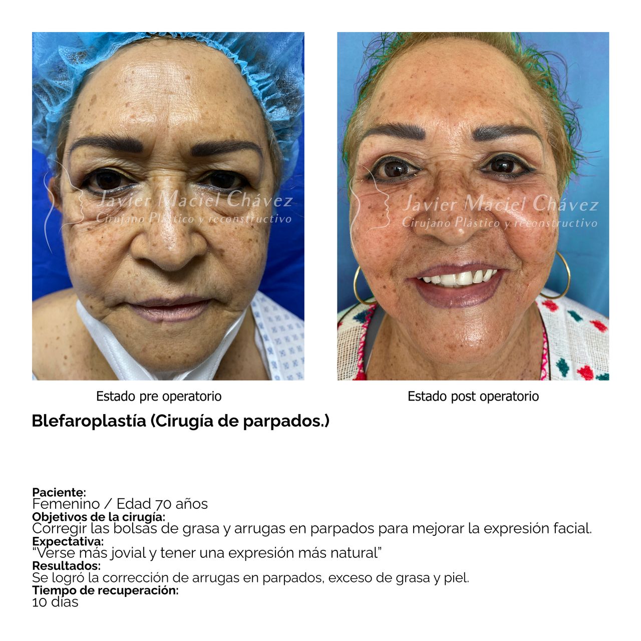 Javier Maciel Chávez-33