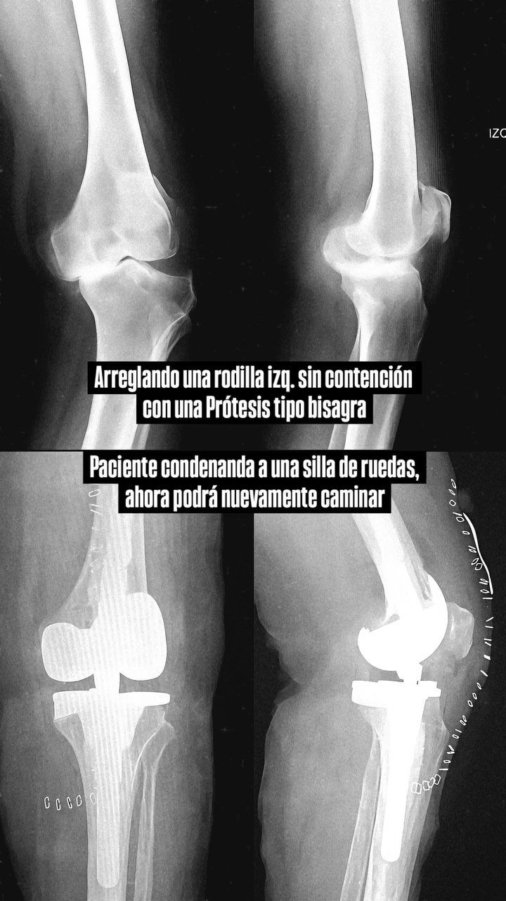 Noé Saavedra Islas-0