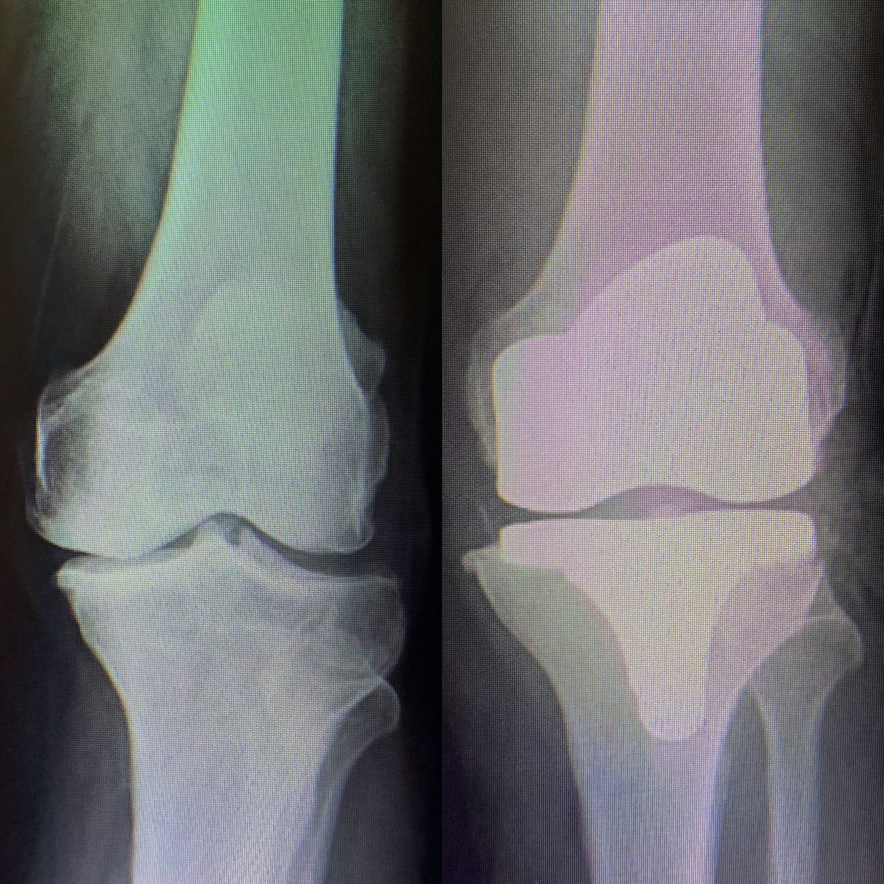 Alfredo Ulixes Coutiño López-2