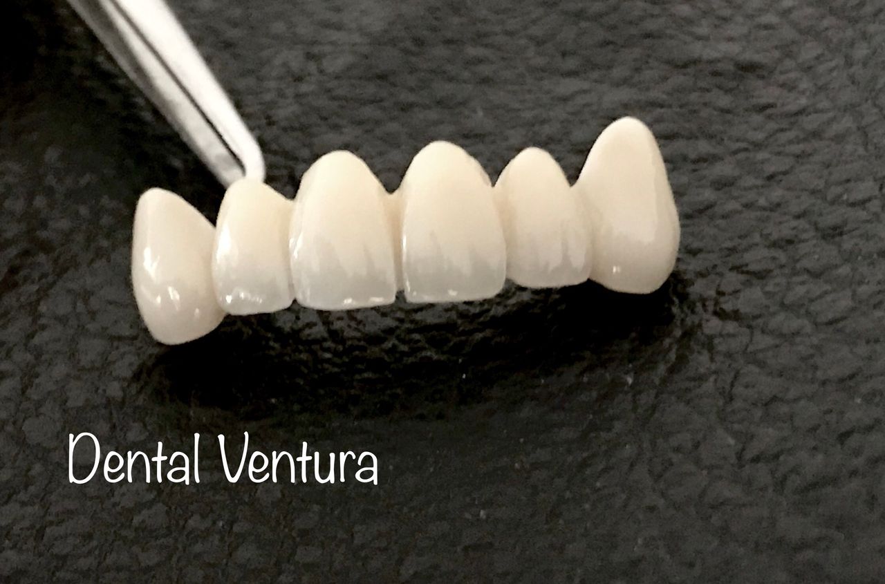 Antonio Cerda Ventura-8