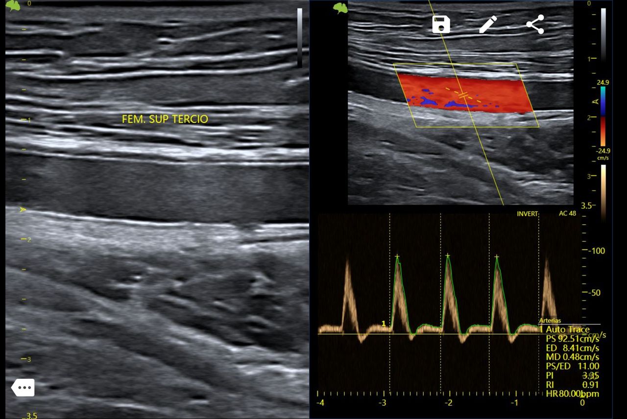 Carlos Ulises Romero Zarate-3