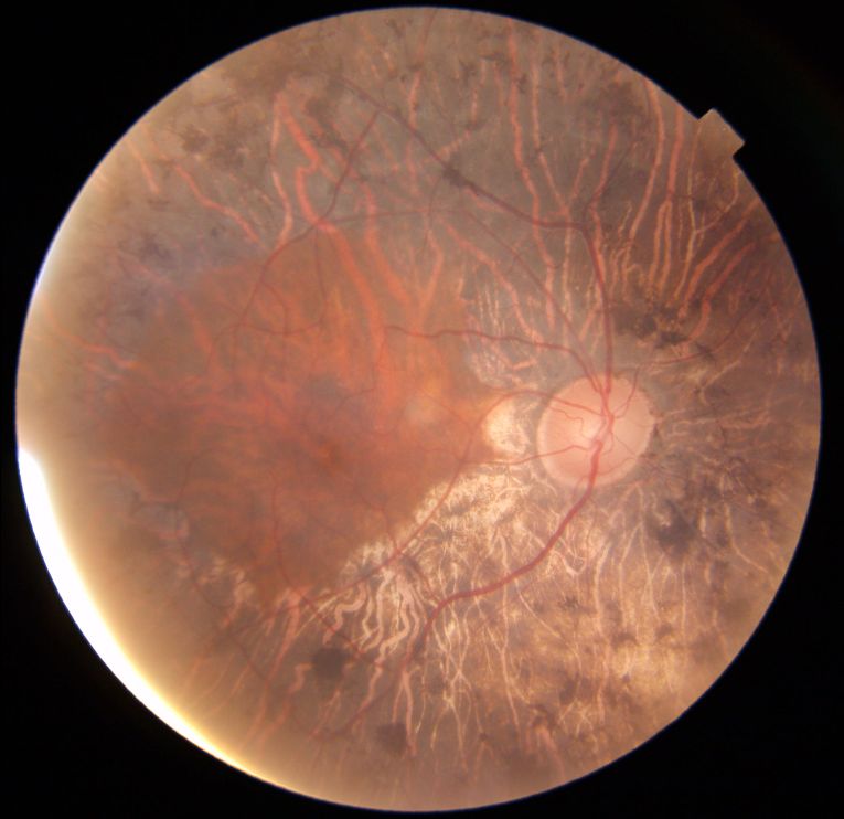 Juan Jose Cueto Gomez-12