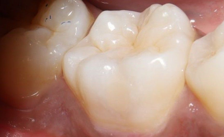 Esmeralda Candida Guerrero Pimentel-36