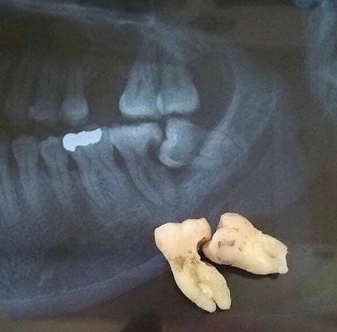 Apolo Espinoza Vega-5