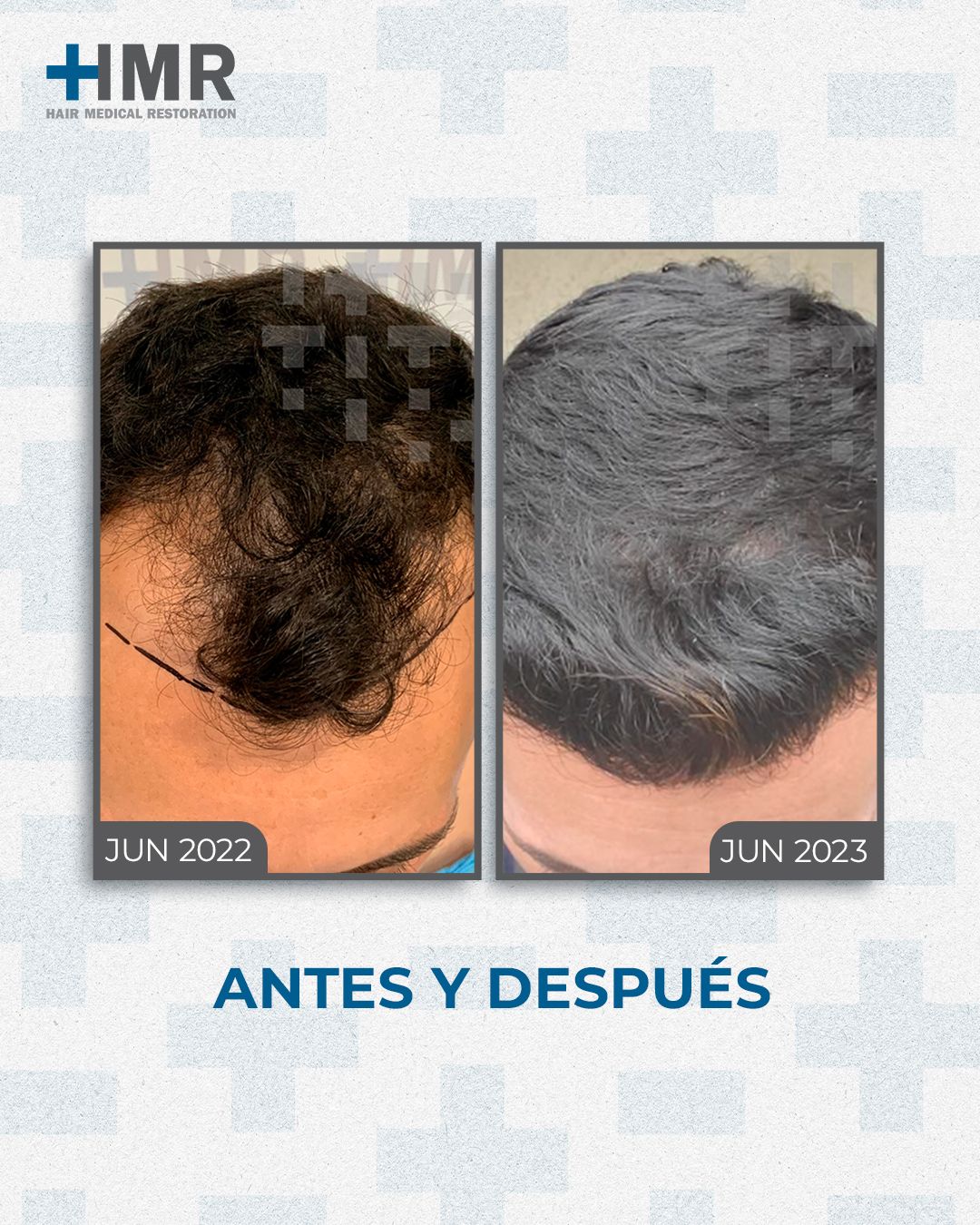 Mendelhsson Mata Cortes-7