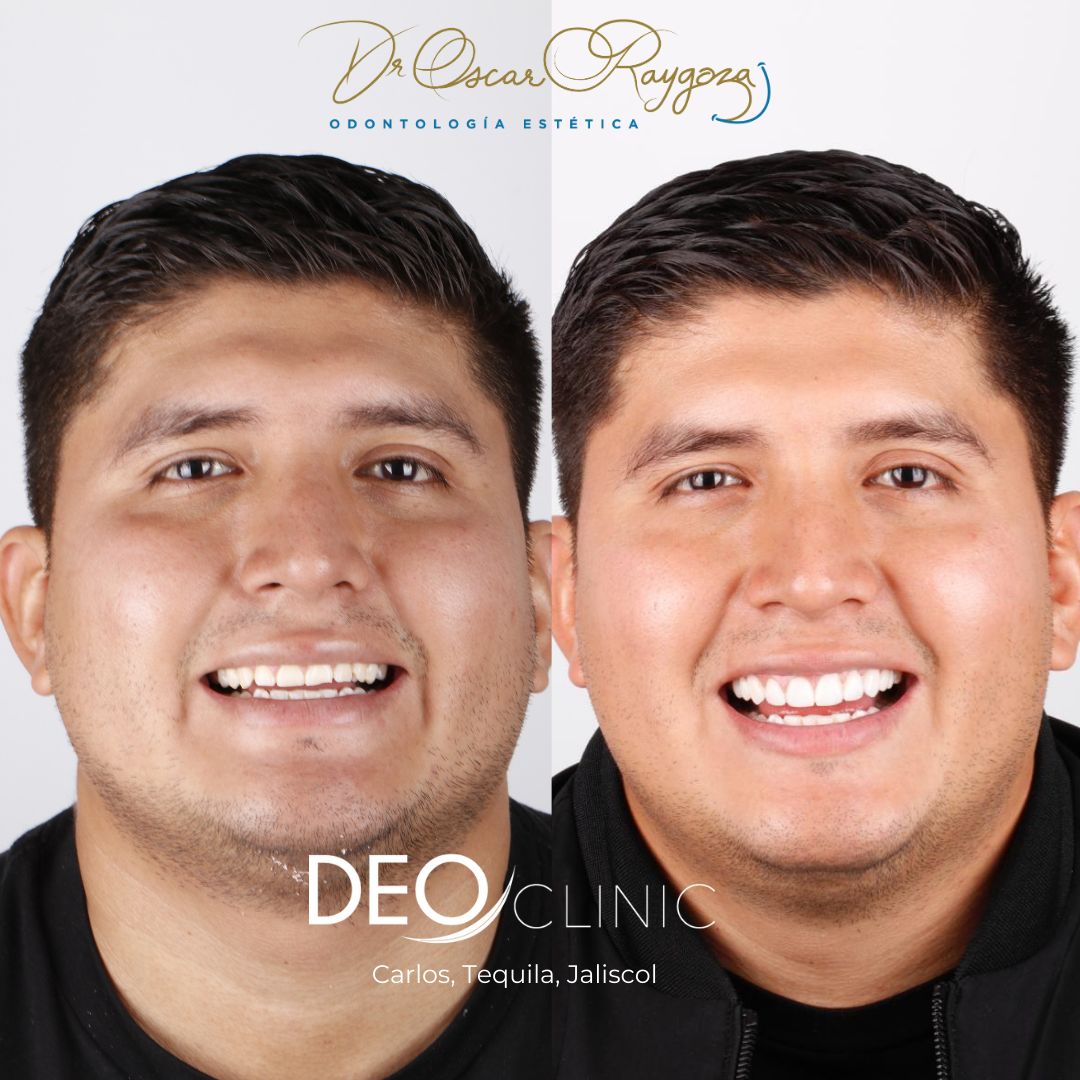 Oscar Raygoza Carrillo-45