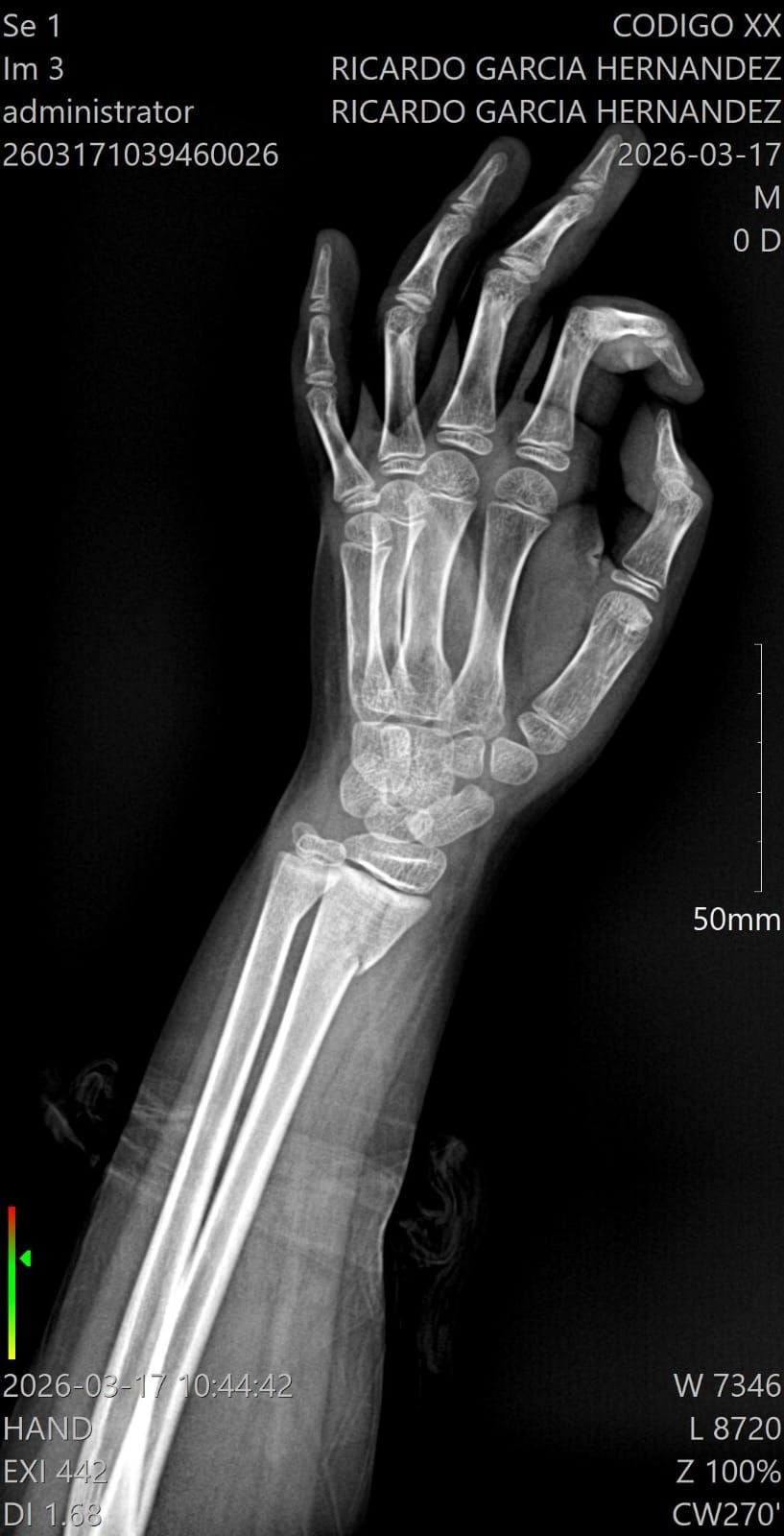 Alejandro Irisson-19