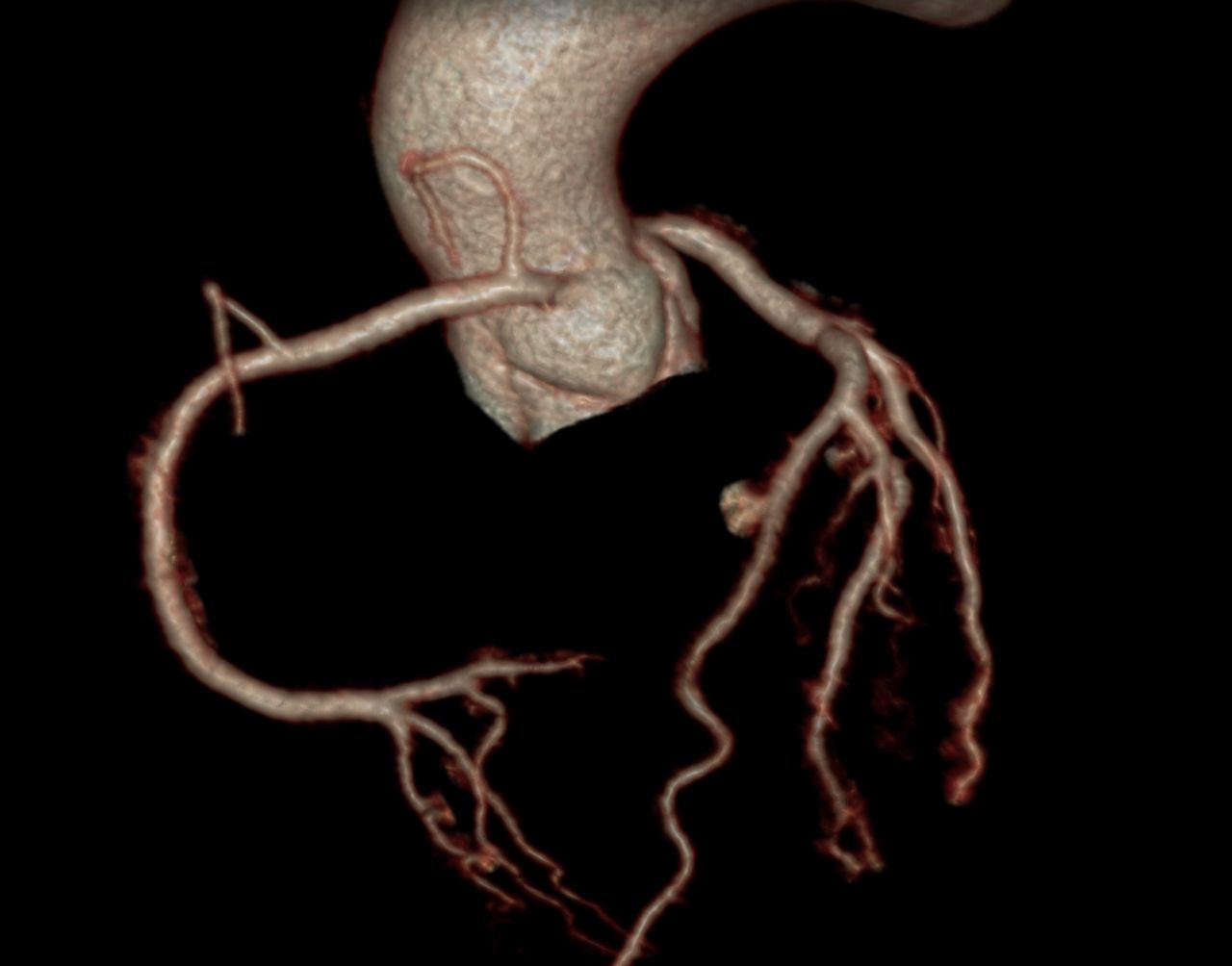 Luis Guillermo Burelo Lopez-13