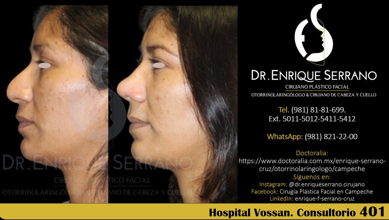 Enrique Serrano Cruz-88