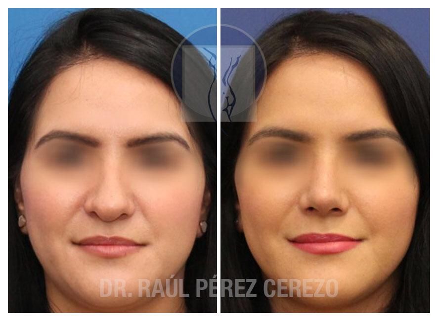 Raúl Pérez Cerezo-21