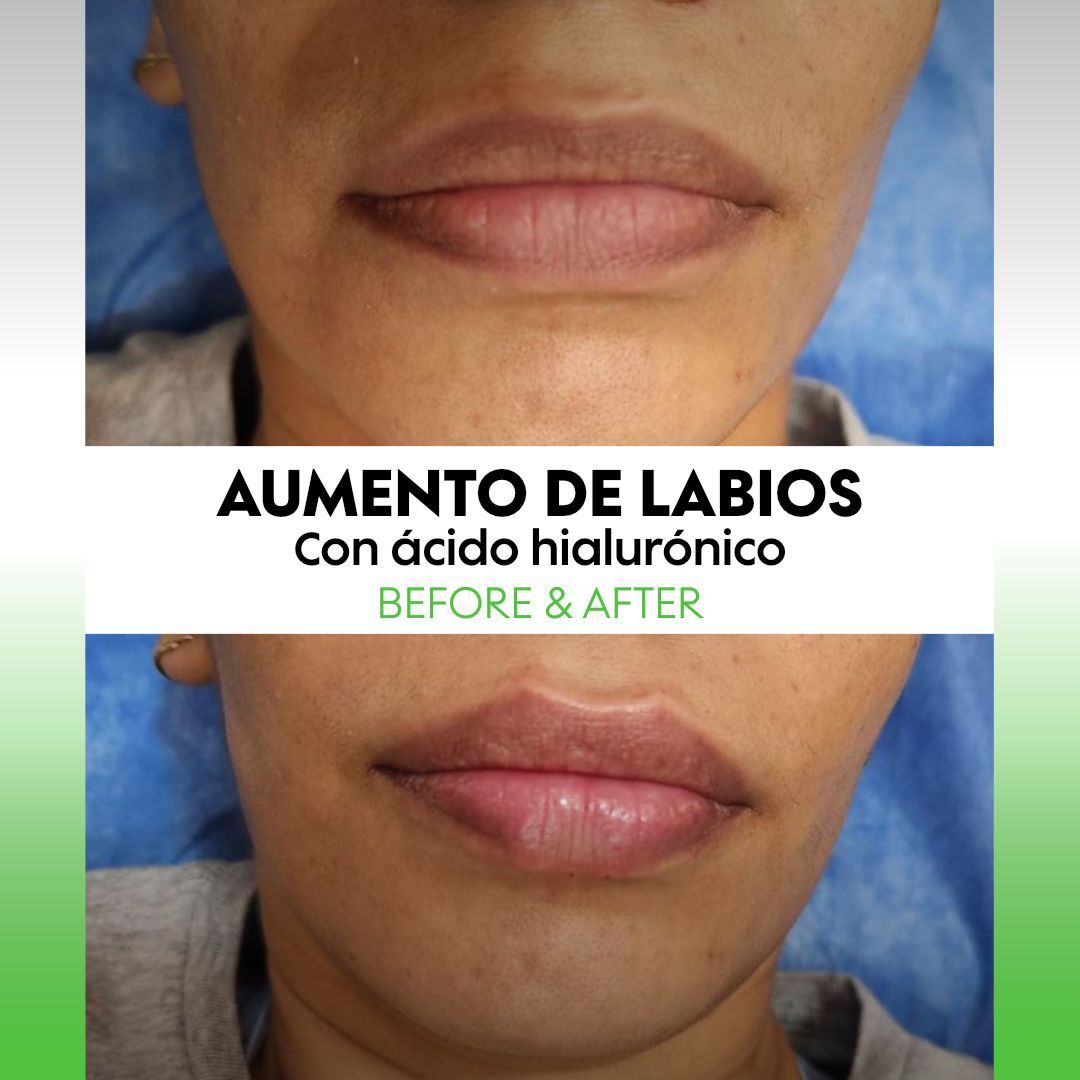 Alejandra Soriano Elorza-112