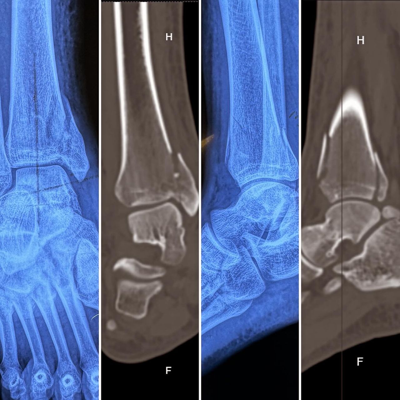 Carlos Enrique Grimaldi Valencia-3
