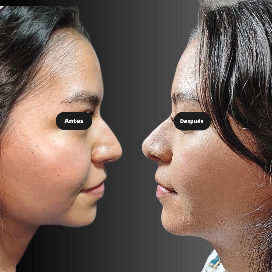 Carlos Alberto Magaña Bustamante-20