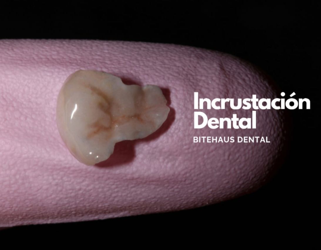 Hylse Najera Moya-13