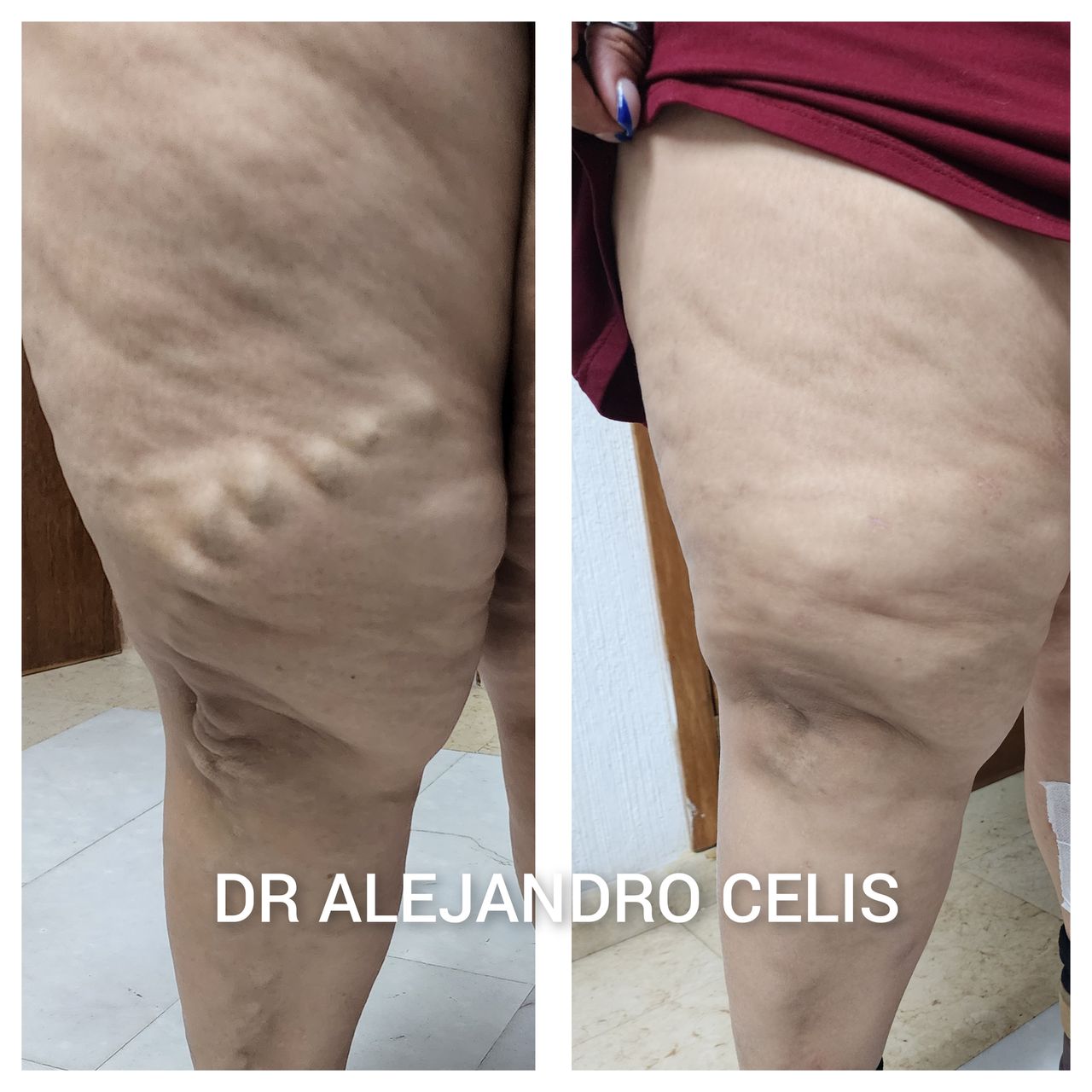 Alejandro Celis Jiménez-4