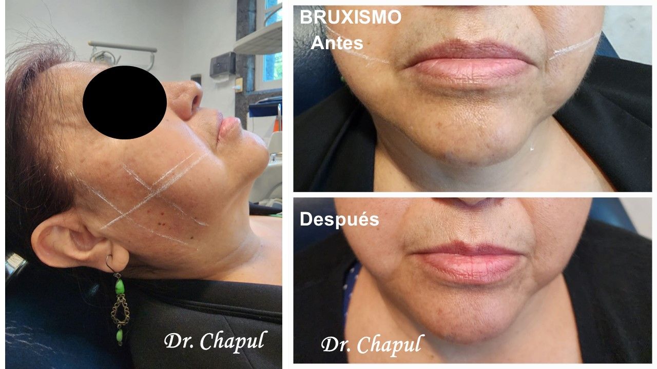 José Luis Muñoz Chapul-35