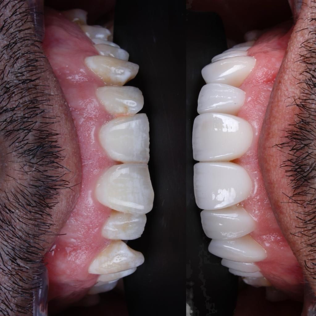 Oscar Raygoza Carrillo-13