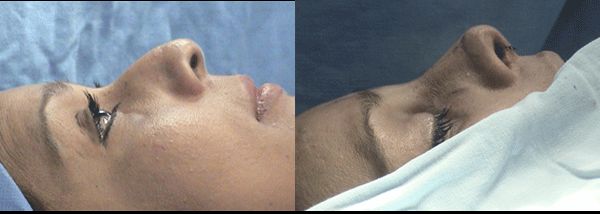 Edgar Ernesto Torres Mejía-41