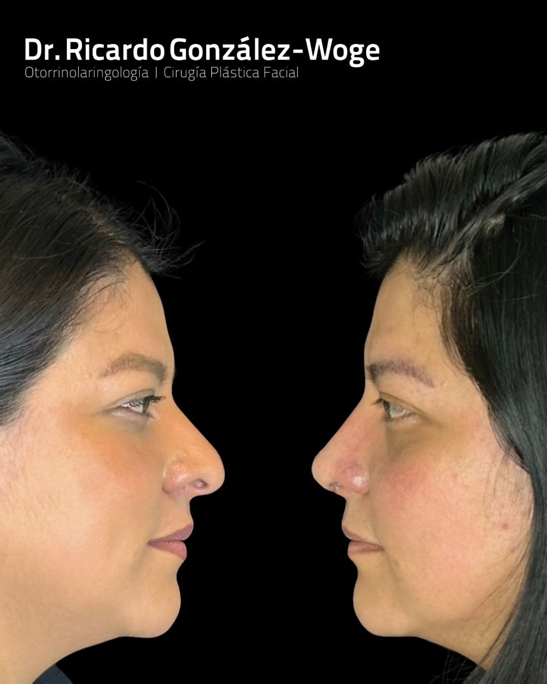 Ricardo Gonzalez Woge-15