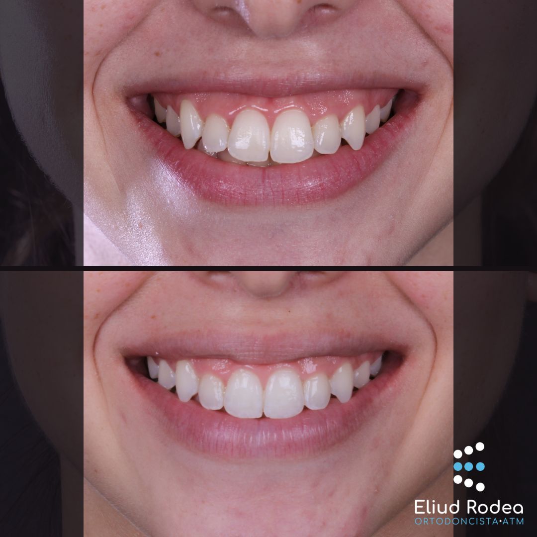 Eliud Rodea Monsivais-0