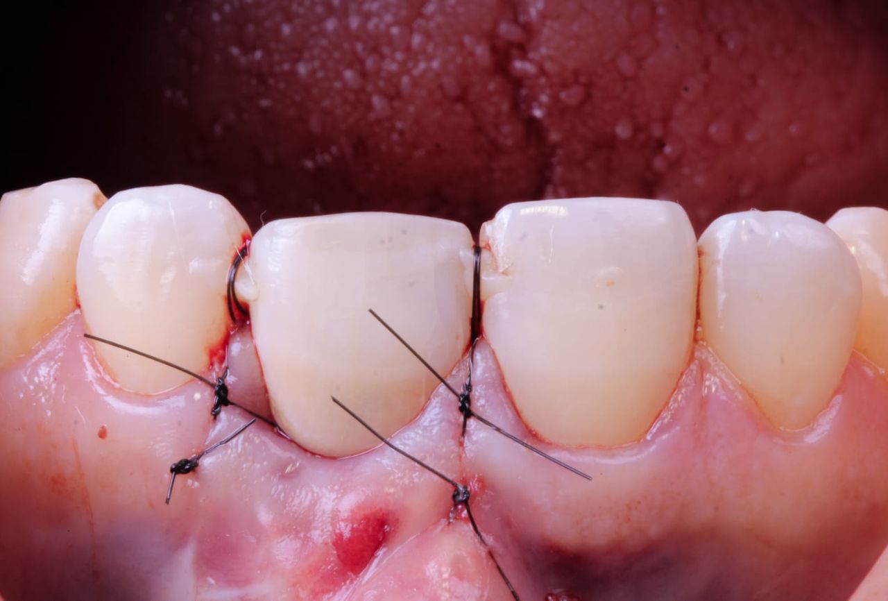 Hugo Enrique Aguilar Lamas-7