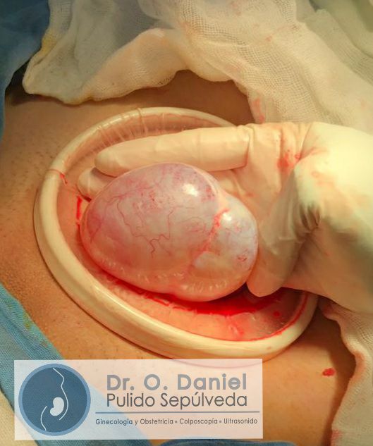 O. Daniel Pulido Sepúlveda-6