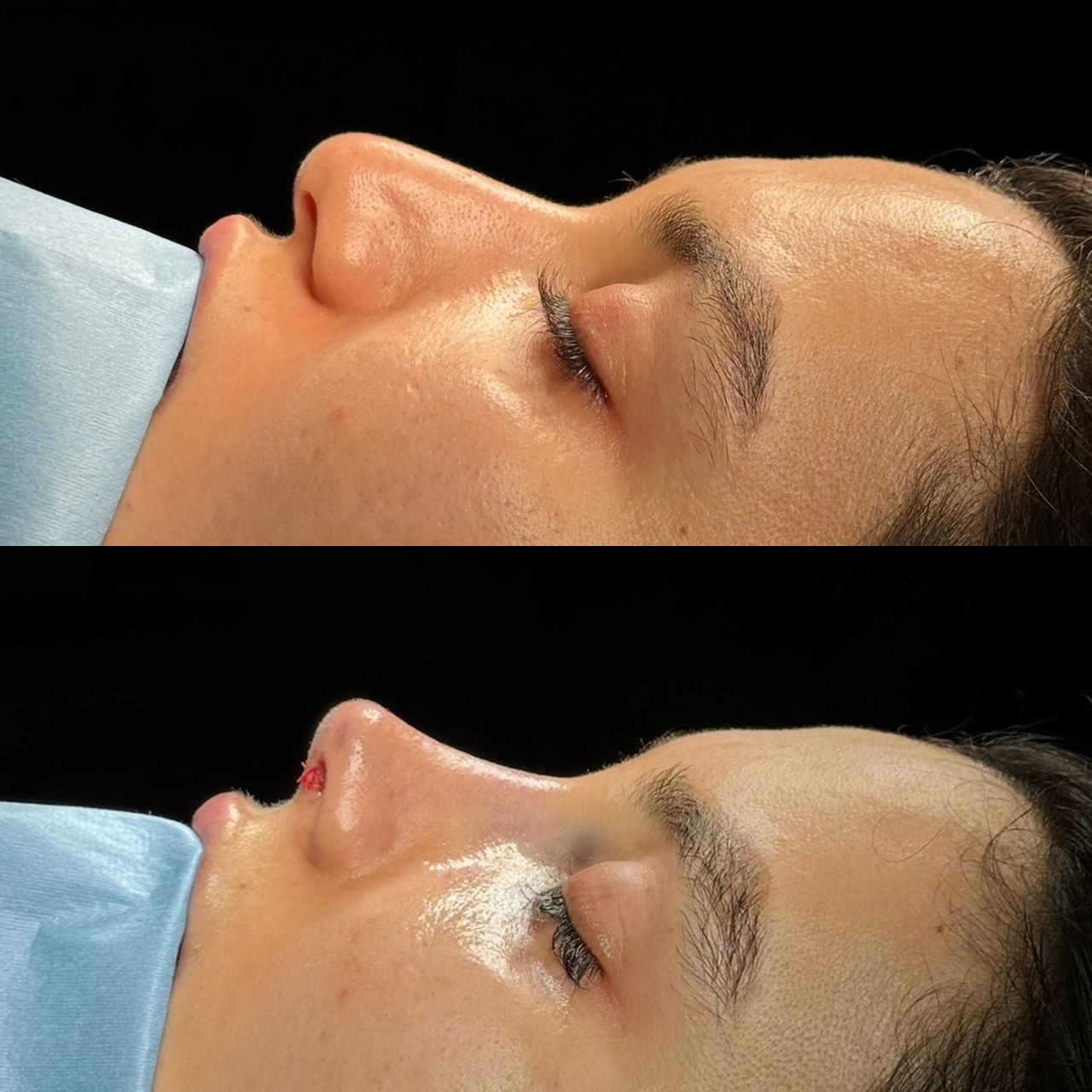 Angel Castro Urquizo-50