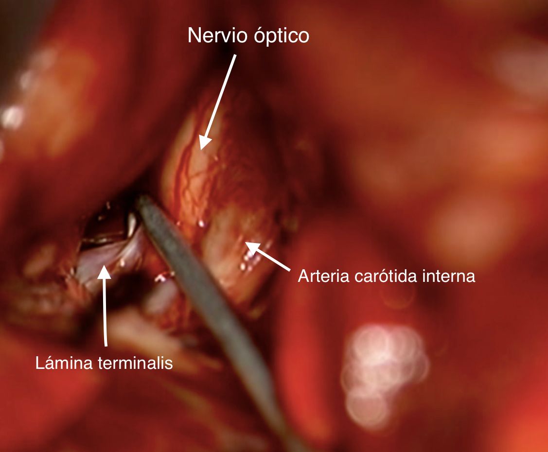Celia Teresa De Jesús Álvarez Gamiño-25
