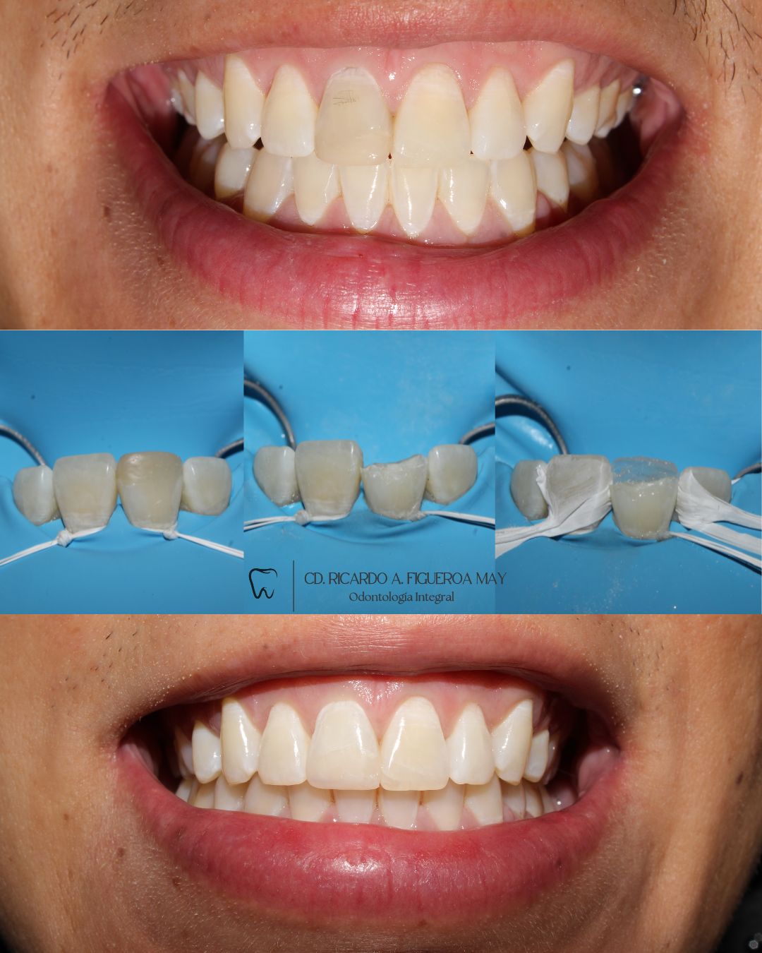 Ricardo Figueroa May-5