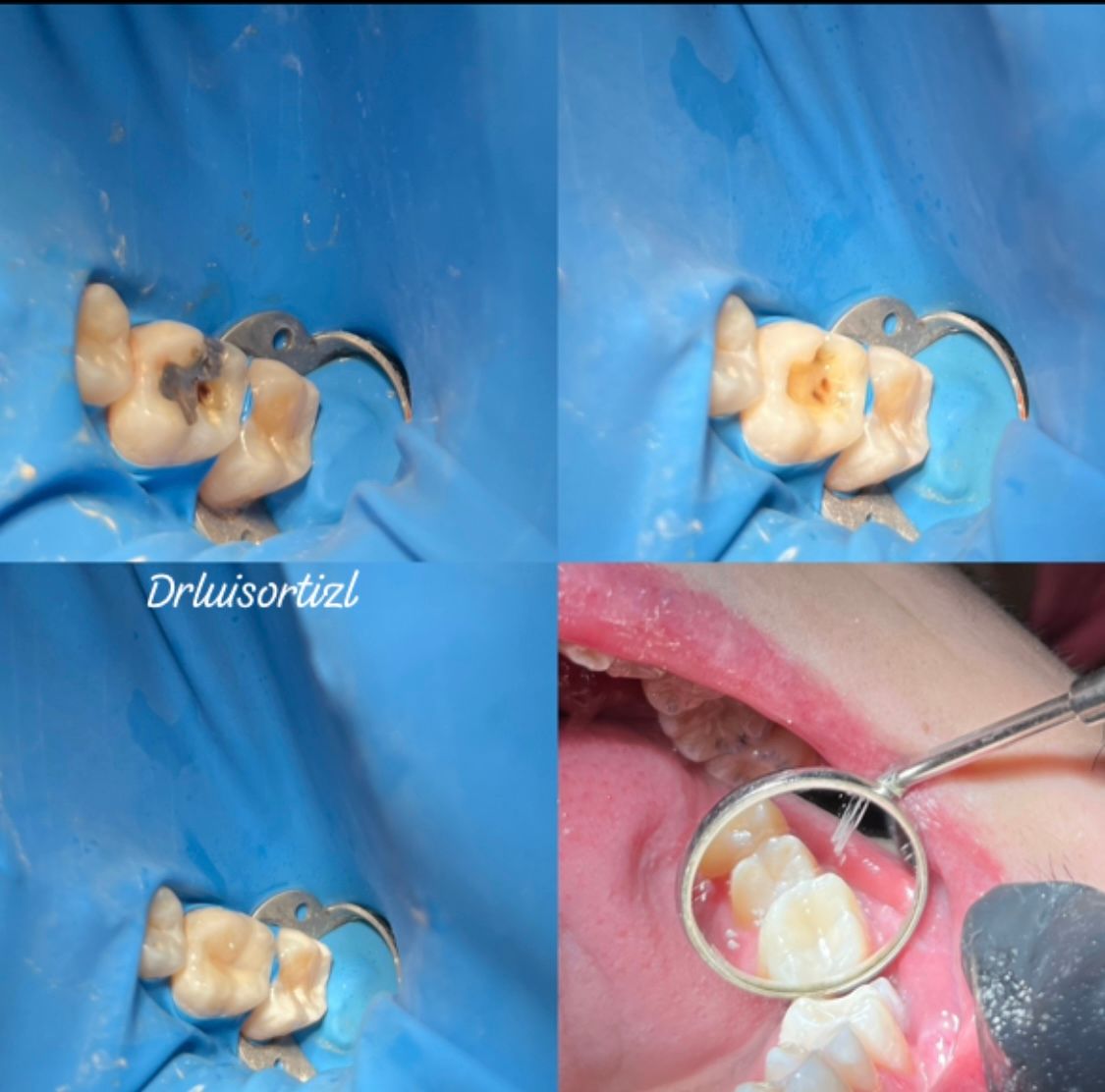 Luis Ángel Ortiz López-6