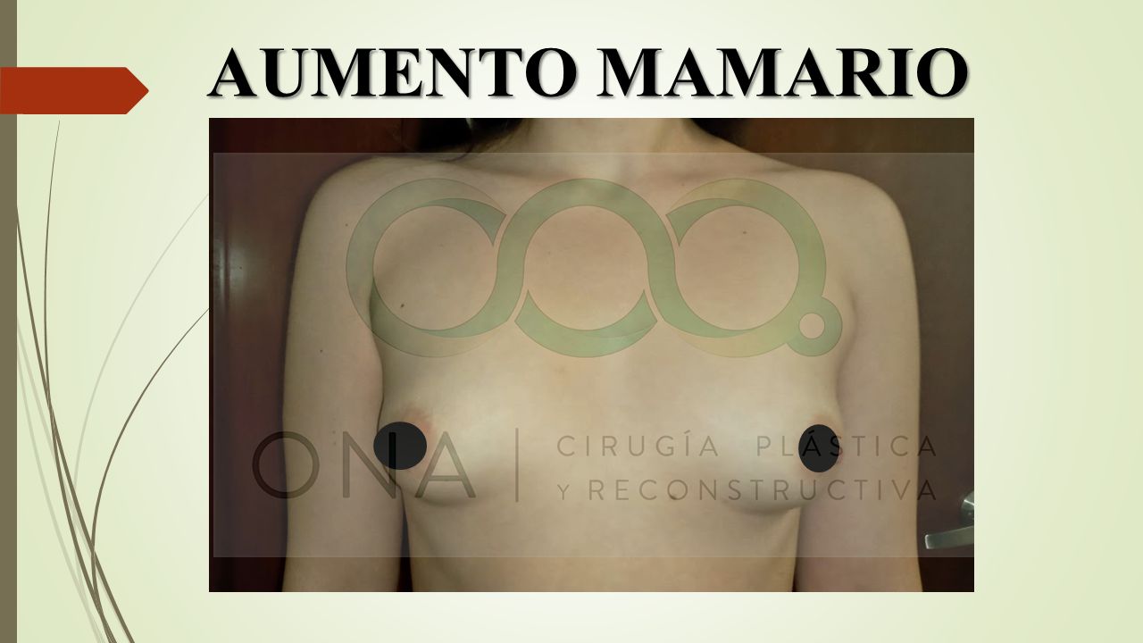 José Luis Segura Castillo-8